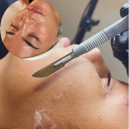 Facial profundo con Dermaplaning, de Maria sol Piccinini estética