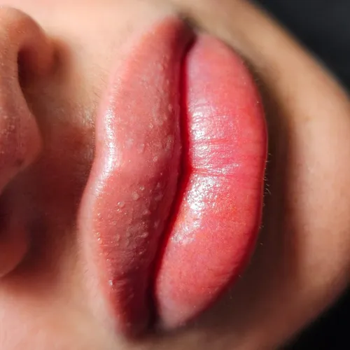 Dermopigmentacion de labios, de Maria sol Piccinini estética