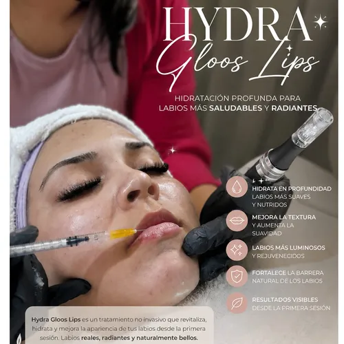 Hydra gloos lips, de Oasis