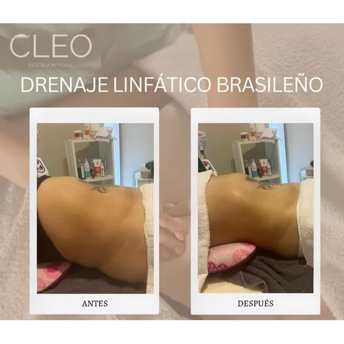 DRENAJE LINFÁTICO BRASILEÑO + MADEROTERAPIA: ABDOMEN, de CLEO ESTÉTICA INTEGRAL