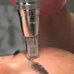 HIGIENE + DERMAPLANING + MICRONEEDLING / FULL RADIANCE, de ZENIA ATELIER