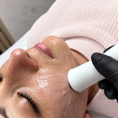 Higiene Facial Profunda con Radiofrecuencia, de OPUS · Flavia Eberlé