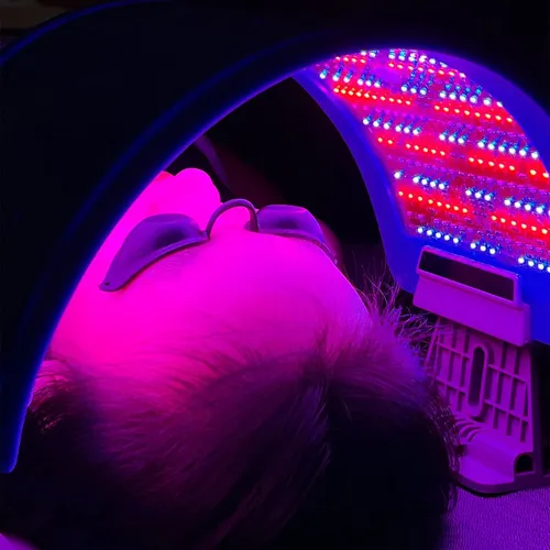 Pack 4 Sesiones Fototerapia LED | Elimina el Acné