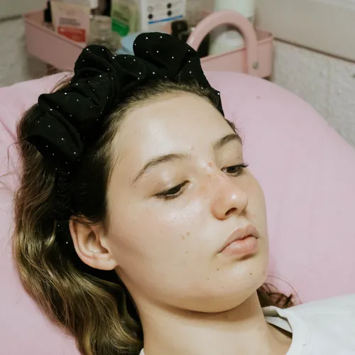 Peeling facial 
