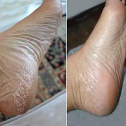 Pedicuria(no incluye esmaltado)