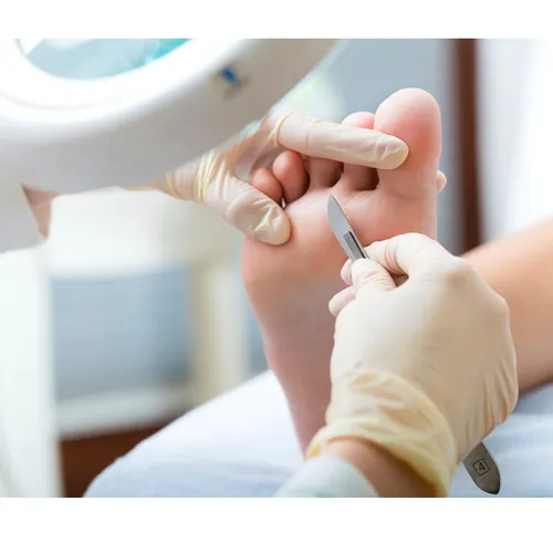 Pedicuria profunda con bisturi