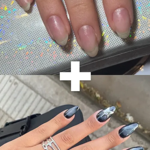 Remocion + Softgel Doble diseño / Diseño complejo