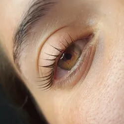 Lifting botox: $28.000