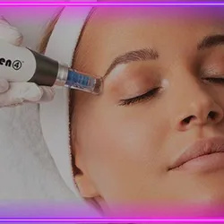 Microneedling con Dermapen