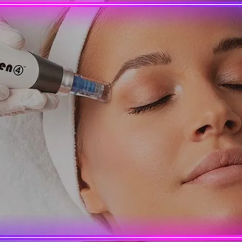 Microneedling con Dermapen