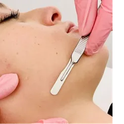 Dermaplaning