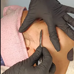 Dermaplaning + higiene profunda 