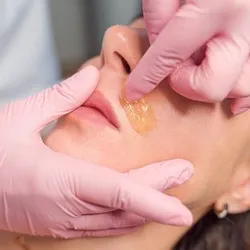 Depilación de rostro completo
