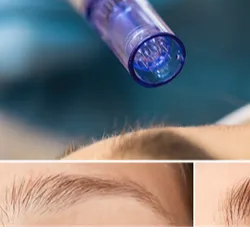 Restauración de cejas