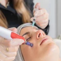 Experiencia Glow (incluye peeling + dermapen/dermaplaning)
