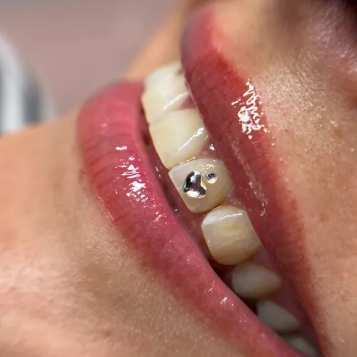 JOYERIA DENTAL