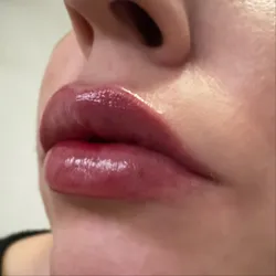 Hidratación labios