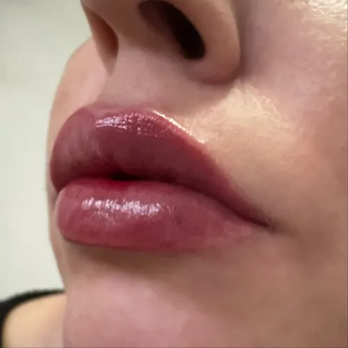Hidratación labios