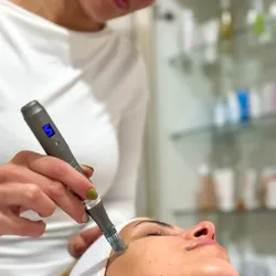 estimulación | microneedling - aparatología