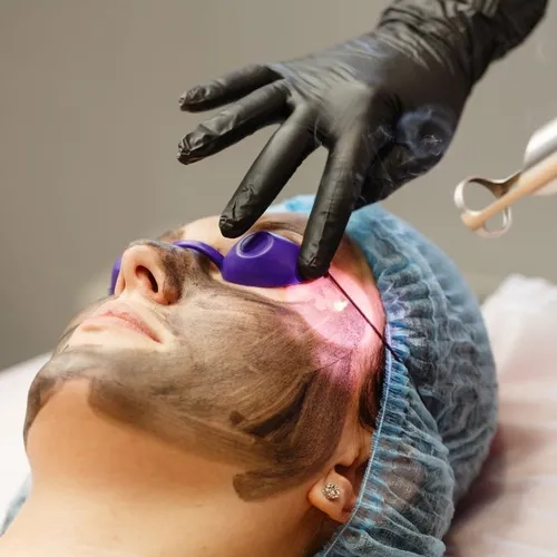Hollywood Peeling 