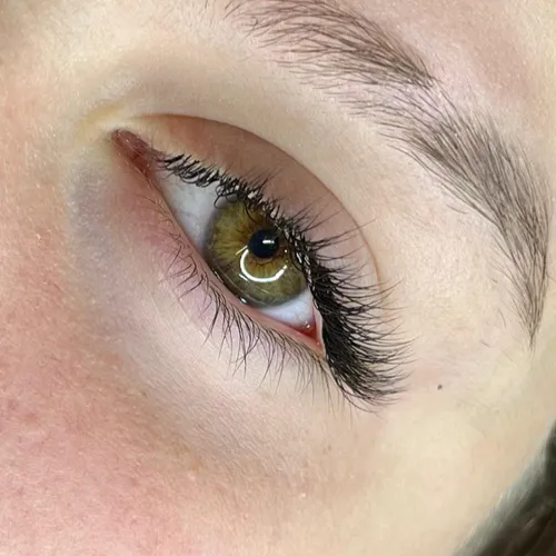 Técnica clasica