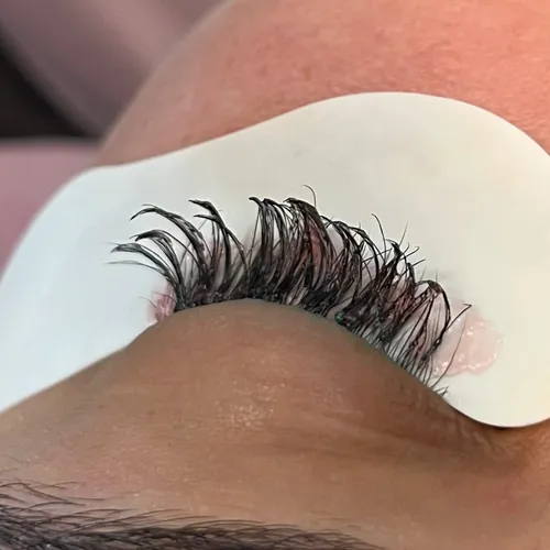 Remoción Total de Extensiones 