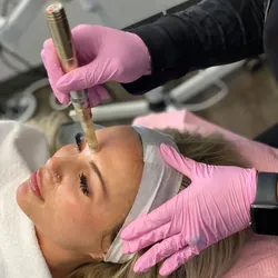 Deep clean+ Microneedling/dermapen