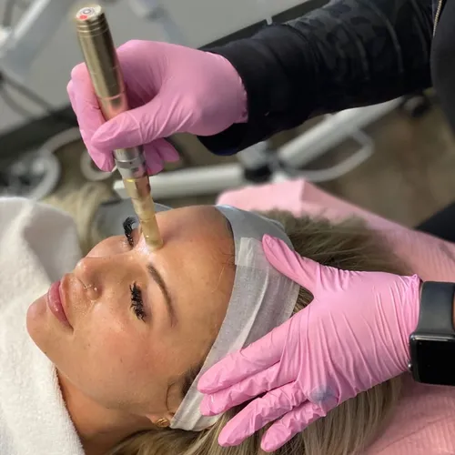 Deep clean+ Microneedling/dermapen