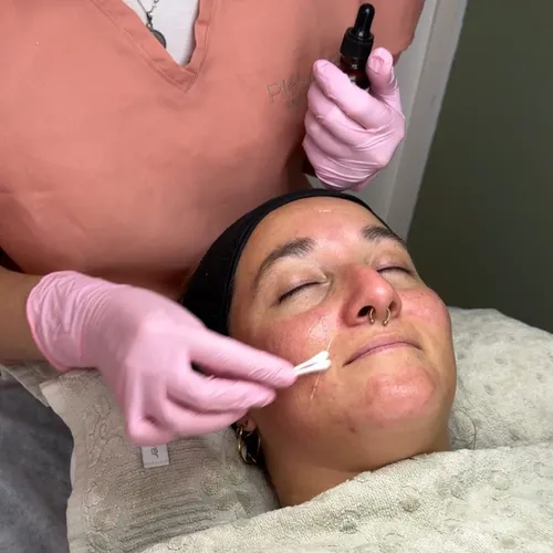 Higiene Facial Profunda + Peeling 🌿