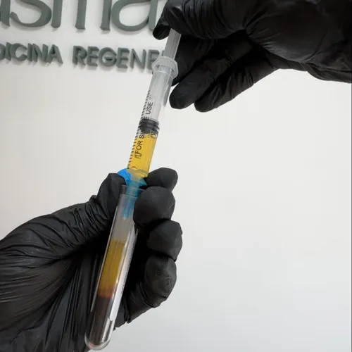 Consulta evaluativa  Plasma Rico en Plaquetas