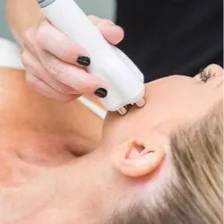 Radiofrecuencia facial 