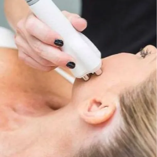 Radiofrecuencia facial 