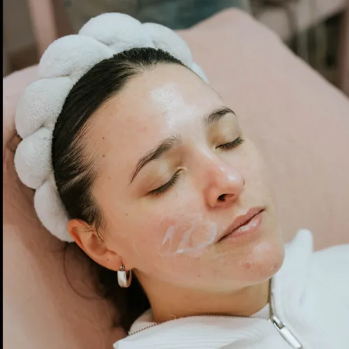 Tratamiento para melasma/manchas