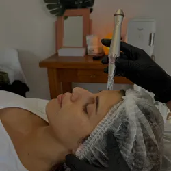 Dermapen
