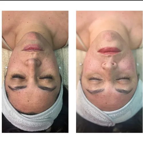 PROMO limpieza facial  + Maderoterapia 