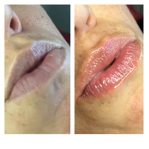 BB Lips (hidratación profunda de labios) 