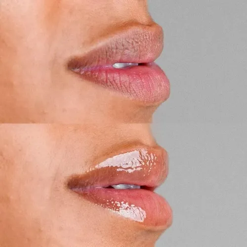 Hydragloss lips