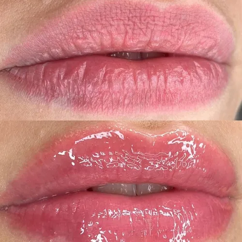 Lipboost ( Bblips ) 1HORA