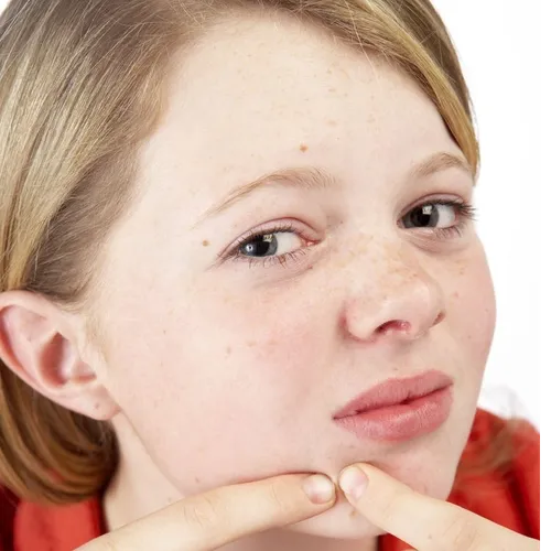 Facial teen 