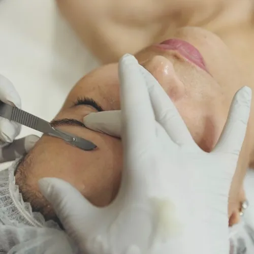 Dermaplaning 