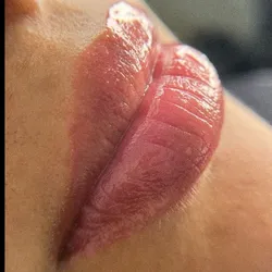 Hidragloss
