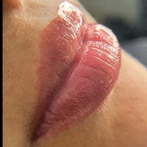Hidragloss