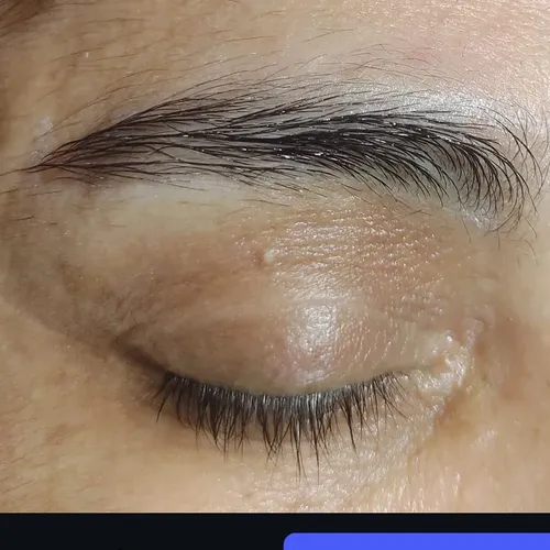 Perfilado de cejas + botox 
