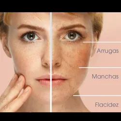  FACIAL DERMAPEN ( Higiene +Dermapen con Activo)
