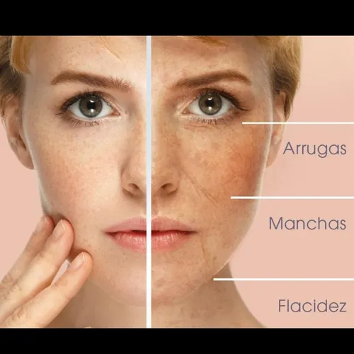  FACIAL DERMAPEN ( Higiene +Dermapen con Activo)