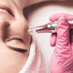 MICRONEEDLING CON DERMAPEN 