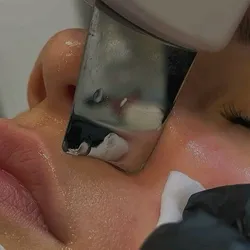 ✨ LIMPIEZA FACIAL PROFUNDA