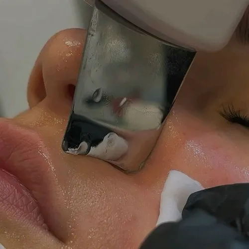✨ LIMPIEZA FACIAL PROFUNDA