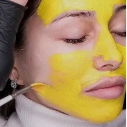 Yellow Peel (peeling ac. retinoico)