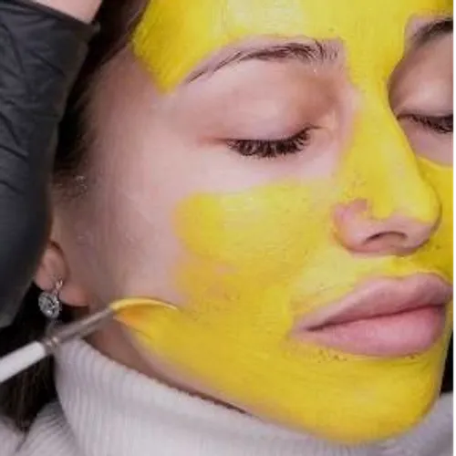 Yellow Peel (peeling ac. retinoico)